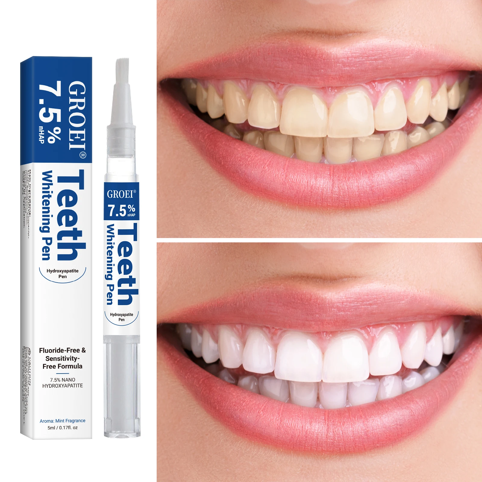 Hydroxyapatite Tooth Whitening - Teeth Whitening Gels Used By Dentists recension och pris