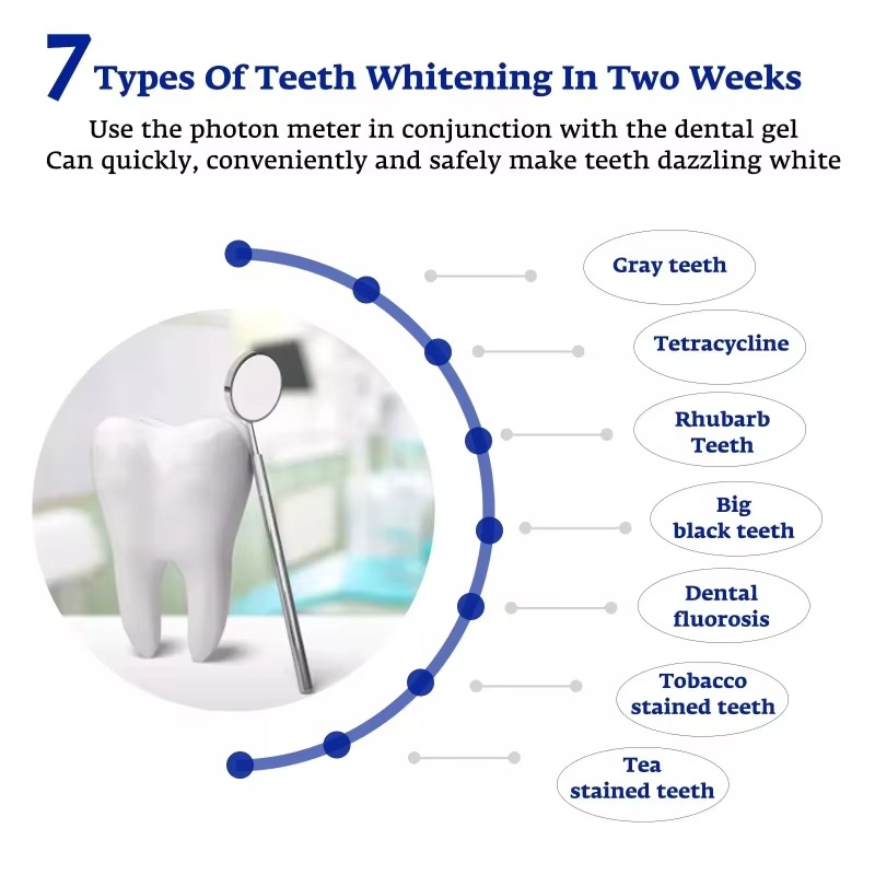 Intelligent LED Blue Light Por - Teeth Whitening Gum recension och pris