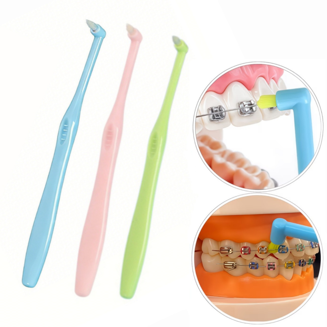 1/3pc Orthodontic Braces Tooth - Teeth Whitening With Braces recension och pris