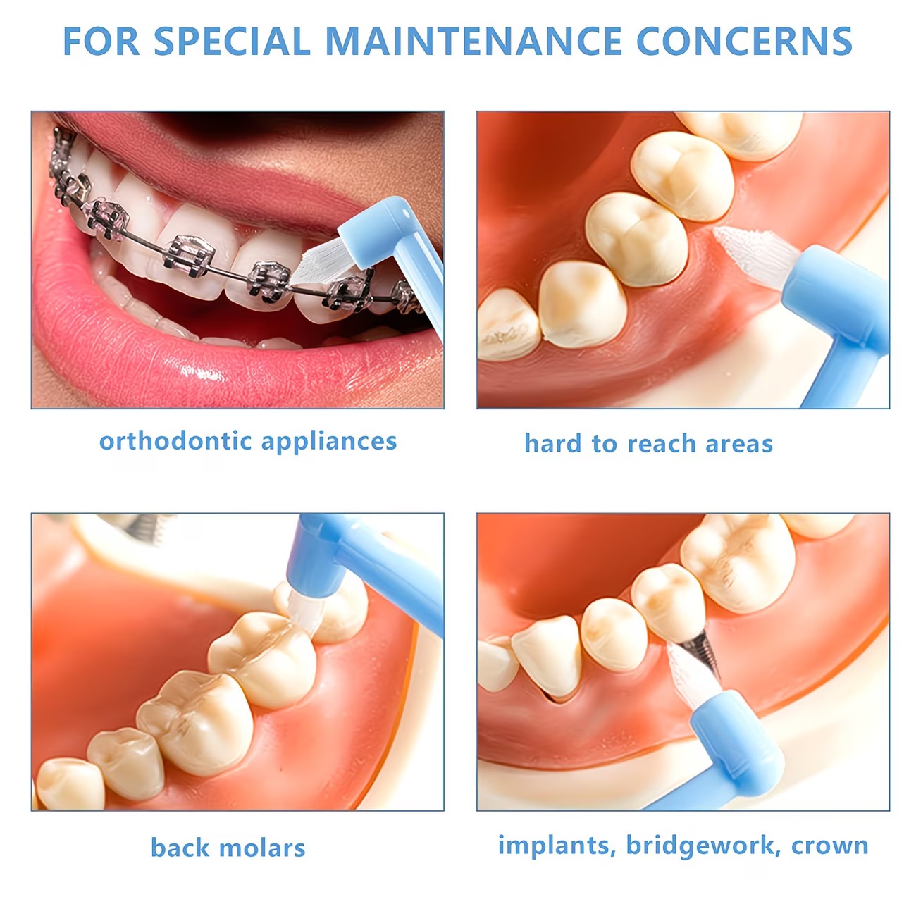1/3pc Orthodontic Braces Tooth - Teeth Whitening With Braces recension och pris
