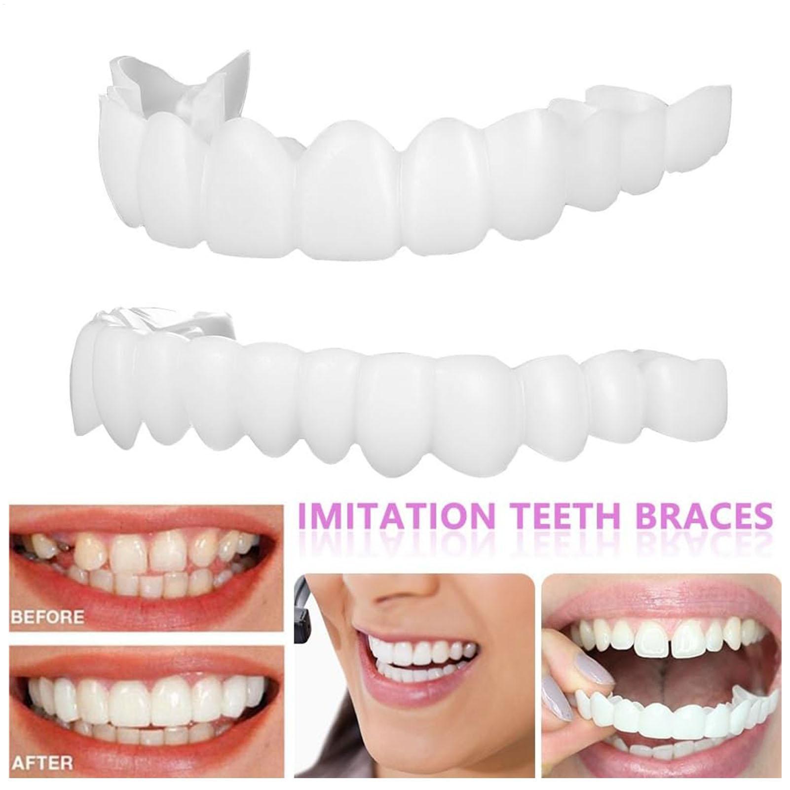 Dental Upper Lower Fake Teeth  - Teeth Whitening With Braces recension och pris