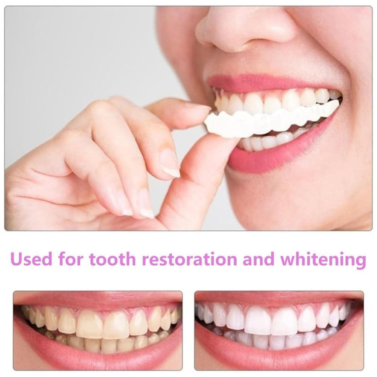 Dental Upper Lower Fake Teeth  - Teeth Whitening With Braces recension och pris