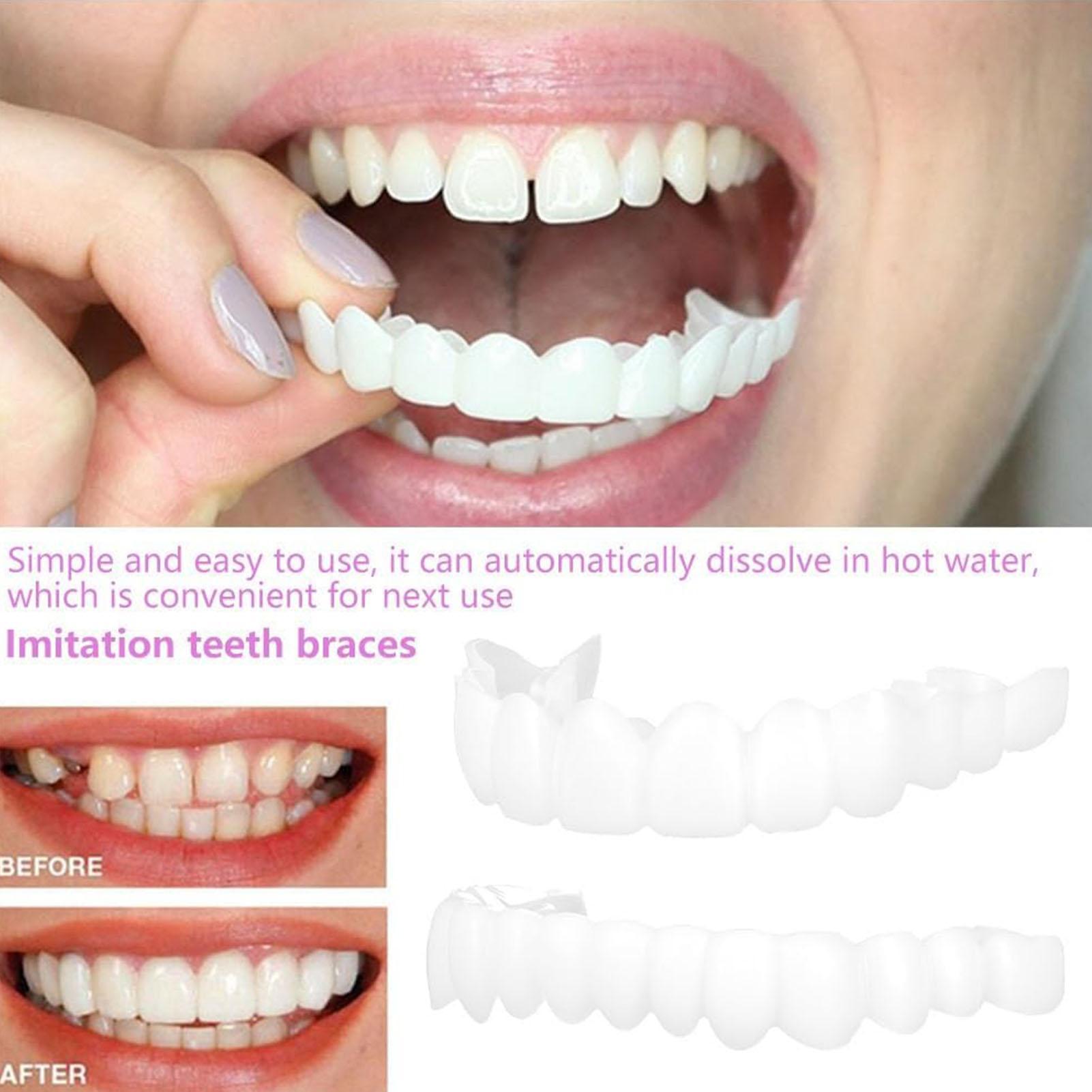 Dental Upper Lower Fake Teeth  - Teeth Whitening With Braces recension och pris