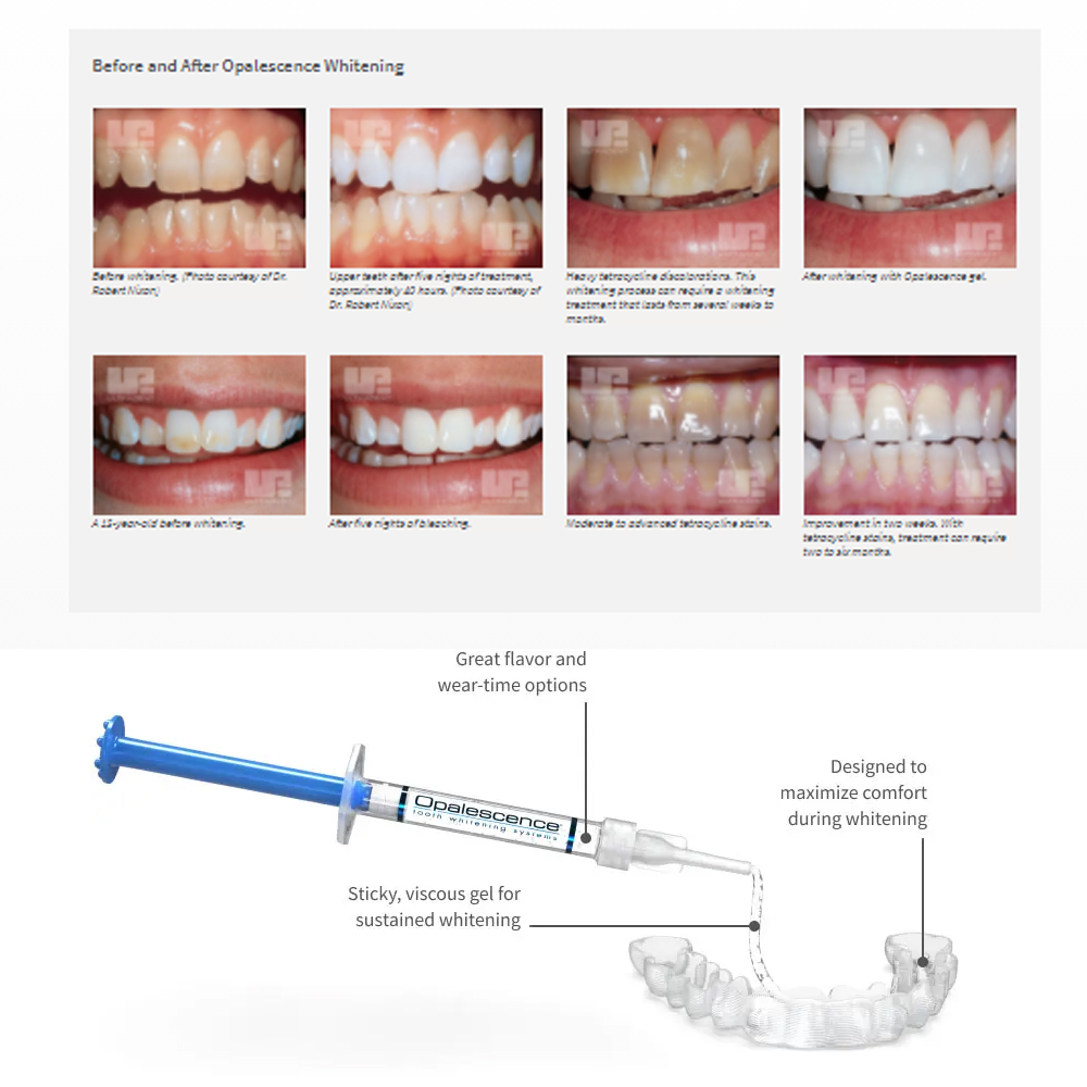 Opalescence Whitening 20% PF 2 - Teeth Whitening Gels Used By Dentists recension och pris
