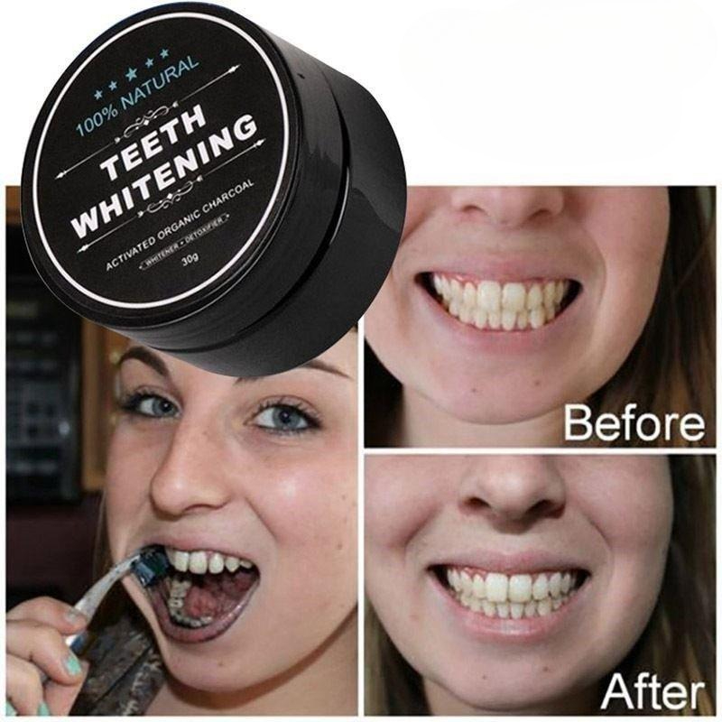 1 Box Activated Charcoal Teeth - Teeth Whitening Co recension och pris