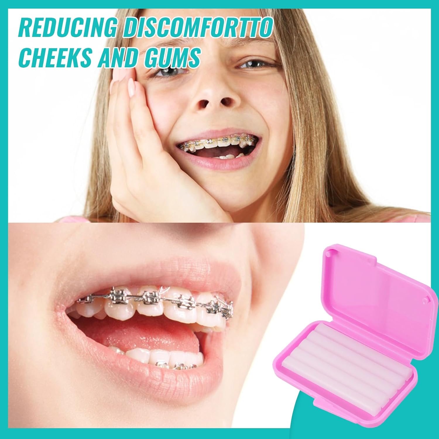 10box Dental Orthodontic Relie - Teeth Whitening With Braces recension och pris