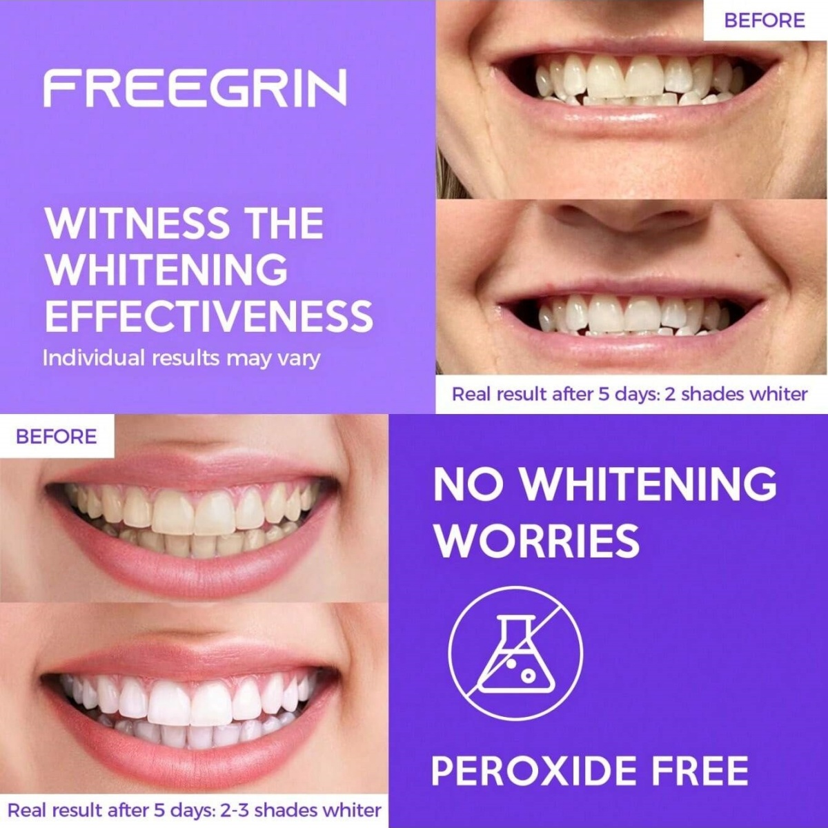 Deluxe Whitening Teeth Sticker - Teeth Whitening From Home recension och pris