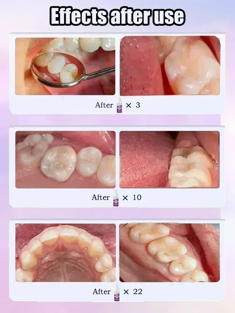 Teeth Cleaning Toothpaste Remo - Teeth Whitening That Works recension och pris
